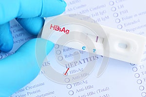 Hepatitis B virus positive test result