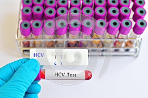 Hepatitis C testing