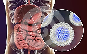 Hepatitis C virus infection medical concept