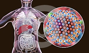 Hepatitis C virus infection medical concept