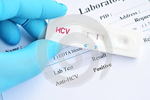 Hepatitis C virus positive test result
