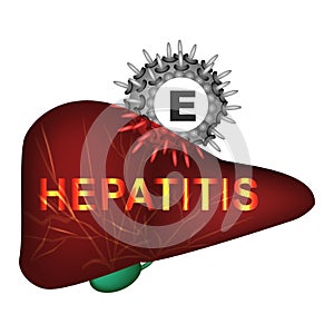 Hepatitis E. World Hepatitis Day. Infographics. Vector illustration on isolated background.