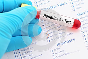 Hepatitis A test