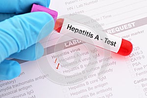 Hepatitis A virus test