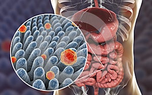 Hepatitis A viruses in small intestine