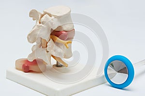 Herniated lumbar disc model and a stethoscope on white background