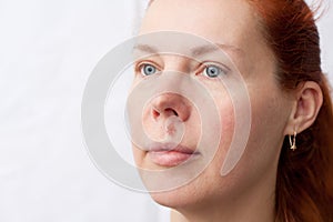 Herpes above upper lip in woman. Portrait middle aged woman with problem skin. Infectious inflammation of face and lips caused by