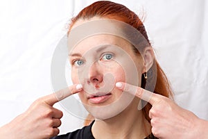 Herpes above upper lip in woman. portrait of middle aged woman with problem skin, on light background. woman pointing fingers at