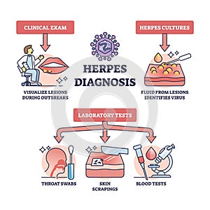 Herpes diagnosis and HSV virus medical diagnosis methods outline diagram