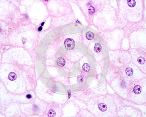 Human hepatocyte. Nucleolus photo
