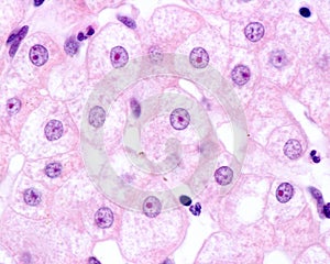 Human hepatocyte. Nucleolus photo
