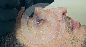 High quality close-up 4k slow motion video of a man laying on a couch during the eye treatment. Doctor nurse applying eye drops. P