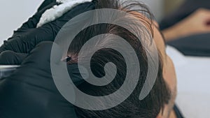 High quality close-up of a man laying on a couch during the esthetician hair treatment. Male tricopigmentation service.