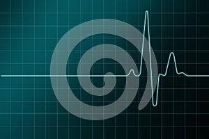 High resulation cardiogram