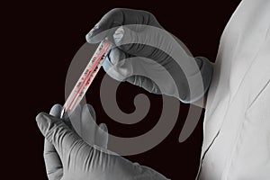 High temperature measurement. Fever or flu virus epidemy concept. Two hands in gloves hold a thermometer with hot red scale on photo