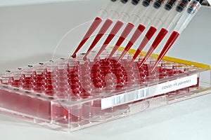 high throughput screening of covid-19 samples with a multichannel pipet in a microtiter plate large scale