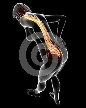 Highlighted back pain Female