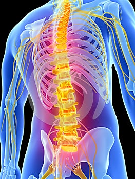Highlighted backache