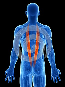 Highlighted iliocostalis