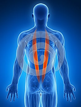 Highlighted iliocostalis