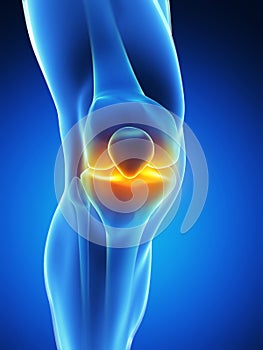 Highlighted knee joint