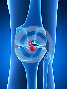 Highlighted knee joint