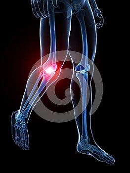 Highlighted knee joint