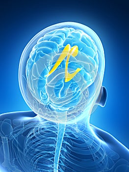 Highlighted lateral ventricle photo