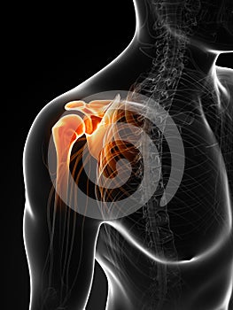 Highlighted painful shoulder