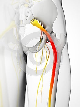 Highlighted sciatic nerve photo