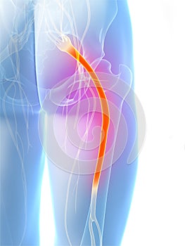 Highlighted sciatic nerve