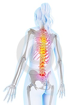 Highlighted spine