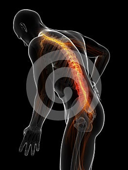 Highlighted spine photo