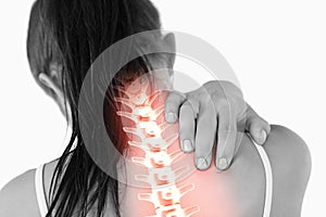 Highlighted spine of woman with neck pain photo