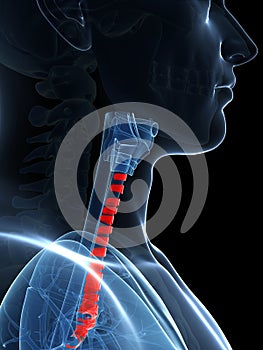Highlighted tracheal rings