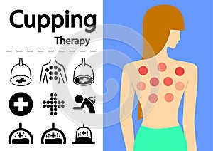 Hijama or Cupping Therapy Icons in flat vector art