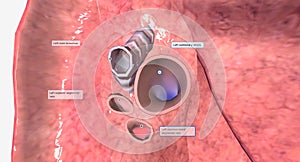 The hilum of each lung is found on the medial or mediastinum facing side of the lungs