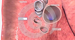 The hilum of each lung is found on the medial or mediastinum facing side of the lungs