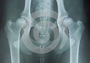 Hip dysplasia photo