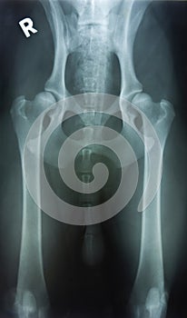 Hip dysplasia photo