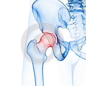 The hip joint