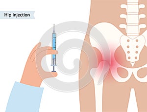 Hip joint injection photo