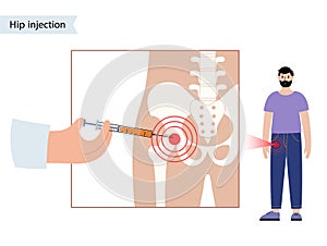 Hip joint injection