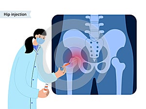 Hip joint injection