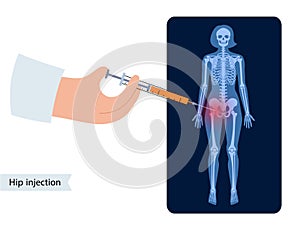 Hip joint injection