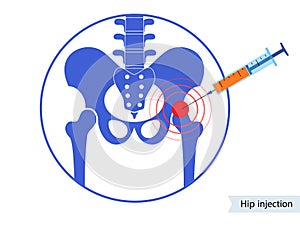 Hip joint injection photo