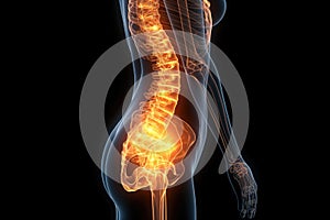 Hip joint pain, lumbar spine hernia, human body with osteoarthritis and scoliosis on a black background, health problems concept,