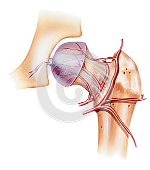 Hip - Osteonecrosis of the Femoral Head photo