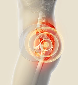 Hip painful skeleton x-ray, 3D illustration.