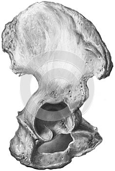 Hip - Pelvic Bone, Os Innominatum